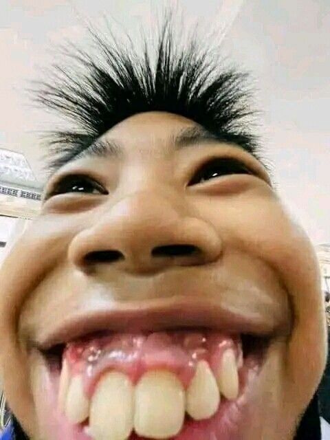 Alexito